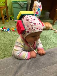 赤ちゃんの頭を守るため母親が作ったユニークな帽子
